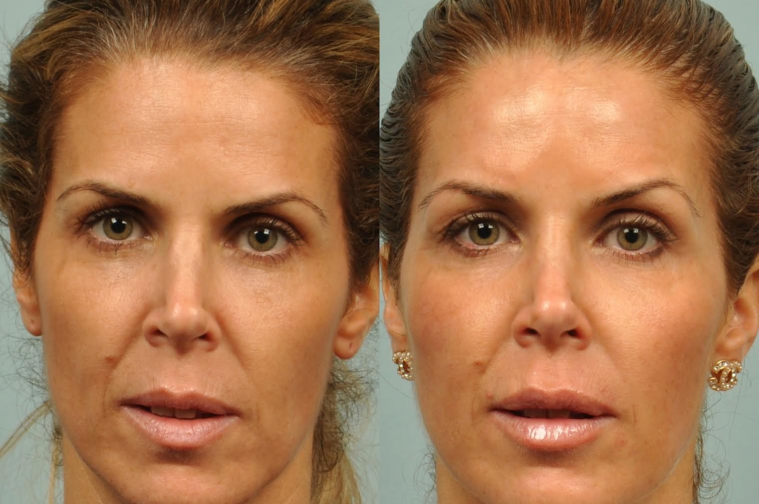 Facial silk sunscreen dr doris day, pics of hardcore rape